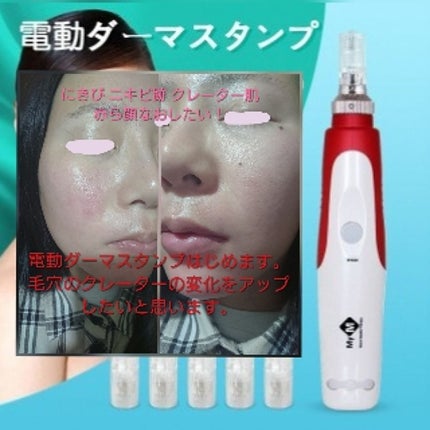 ドクタージャルト シカペア クリーム (第2世代)/Dr.Jart+/フェイスクリームを使ったクチコミ(1枚目)