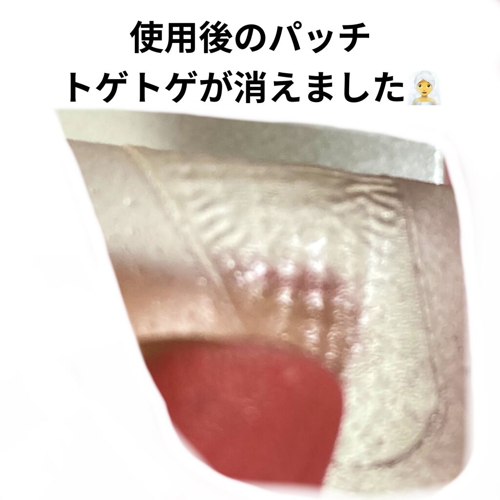 ヒアロビューティーマイクロパッチ/太陽のアロエ社/シートマスク・パックを使ったクチコミ（3枚目）