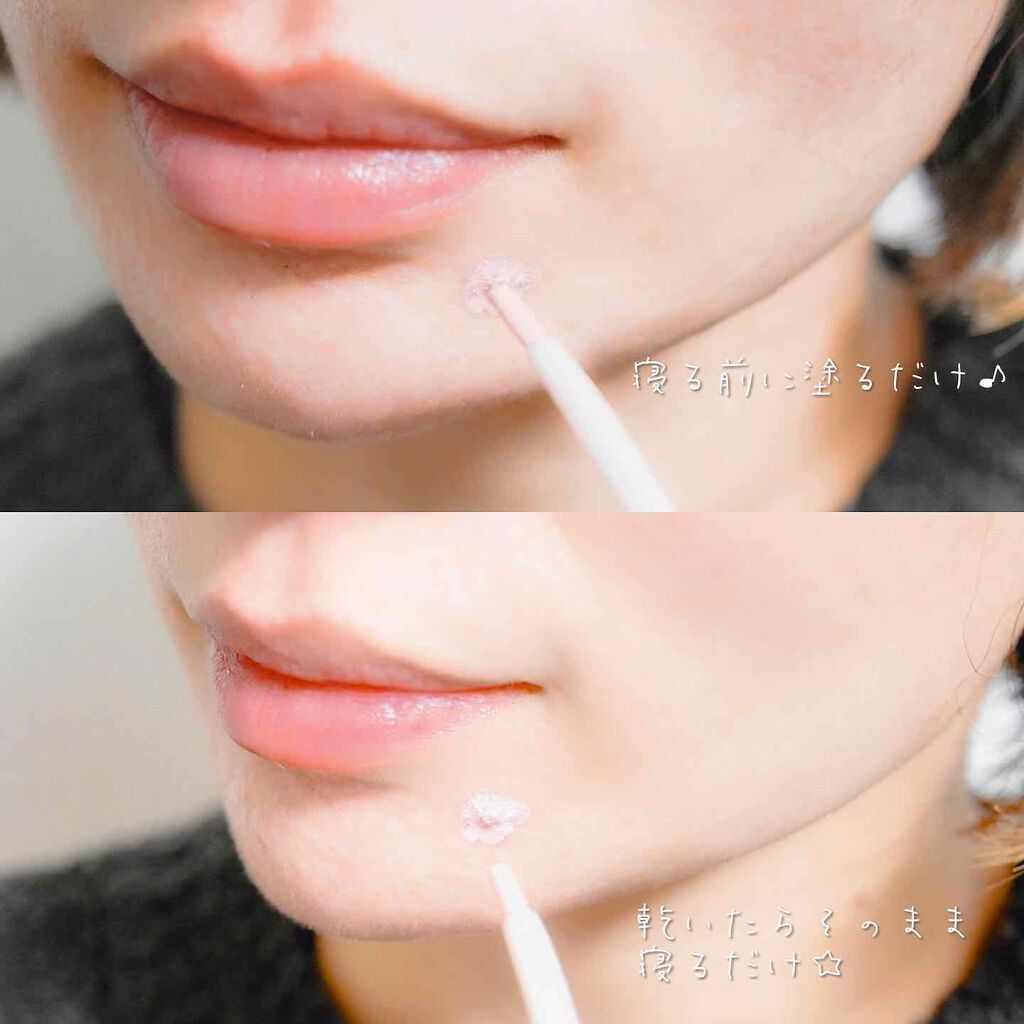 スポットパウダーエッセンス/ポツント/美容液を使ったクチコミ(4枚目)