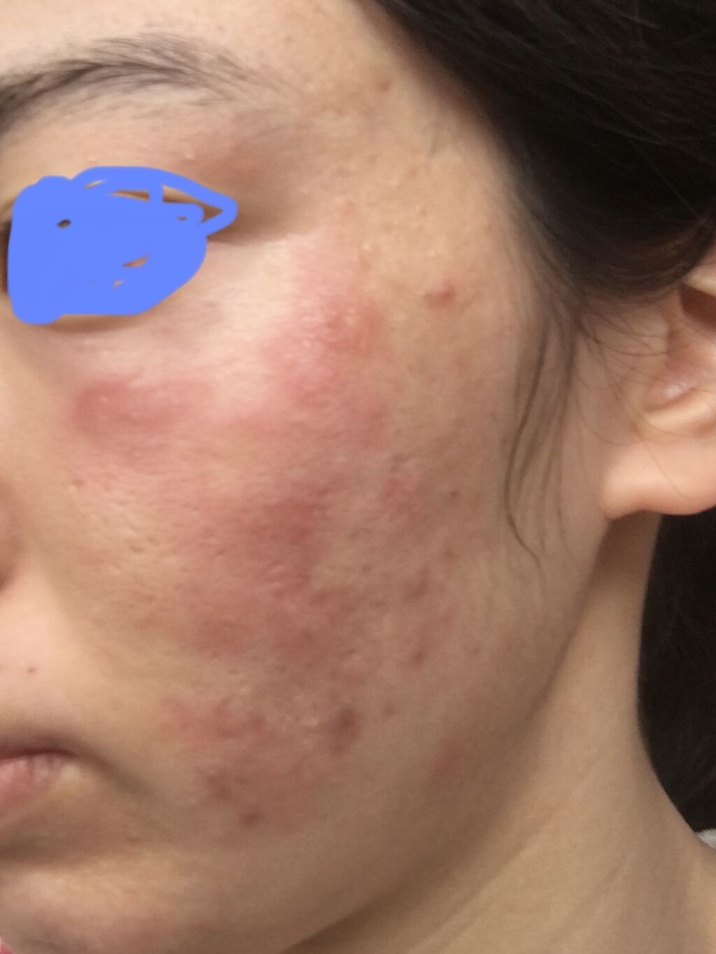 ドクタージャルト シカペアセラム	/Dr.Jart＋/美容液を使ったクチコミ（2枚目）