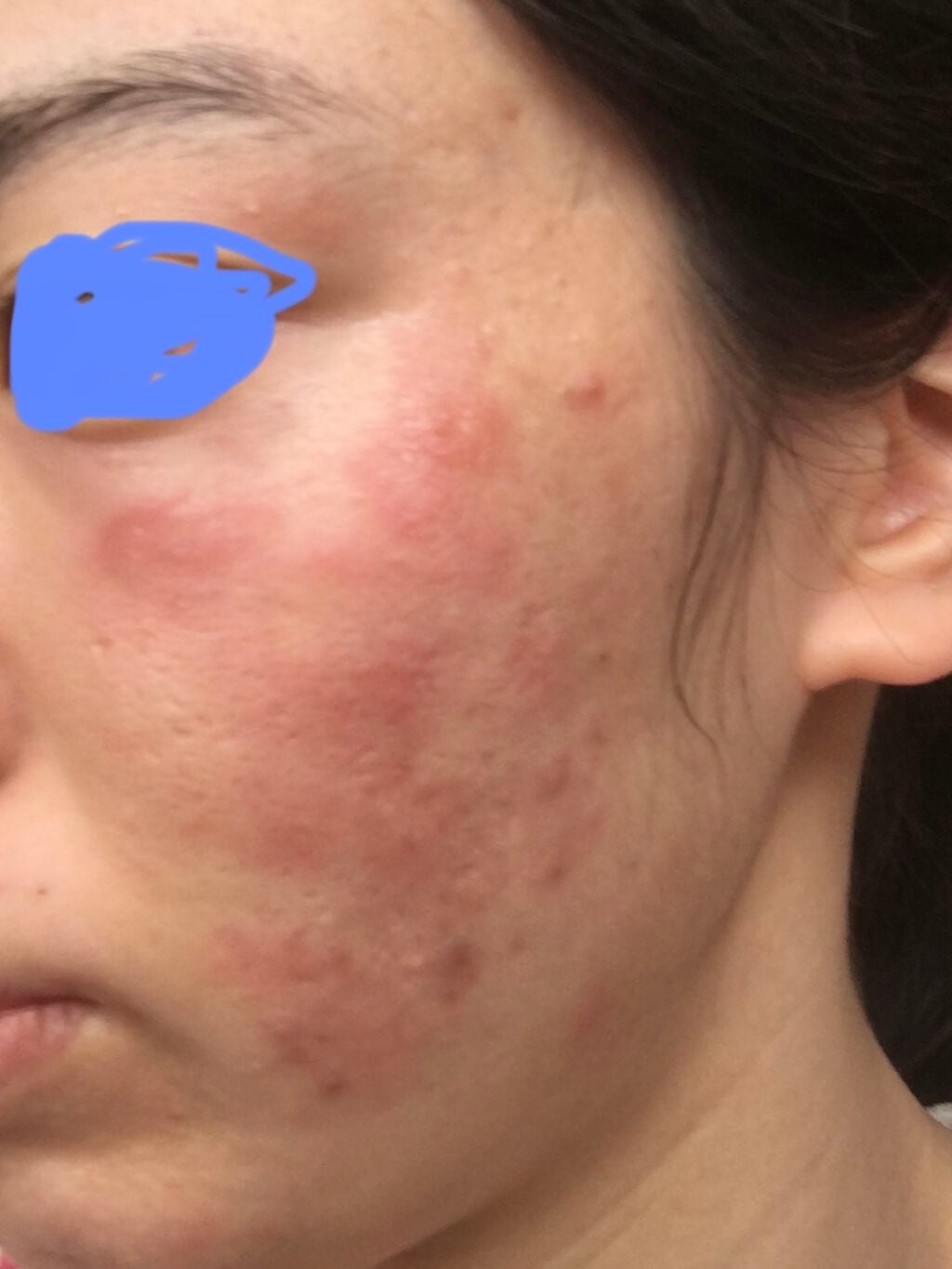 ドクタージャルト シカペアセラム /Dr.Jart+/美容液を使ったクチコミ(2枚目)