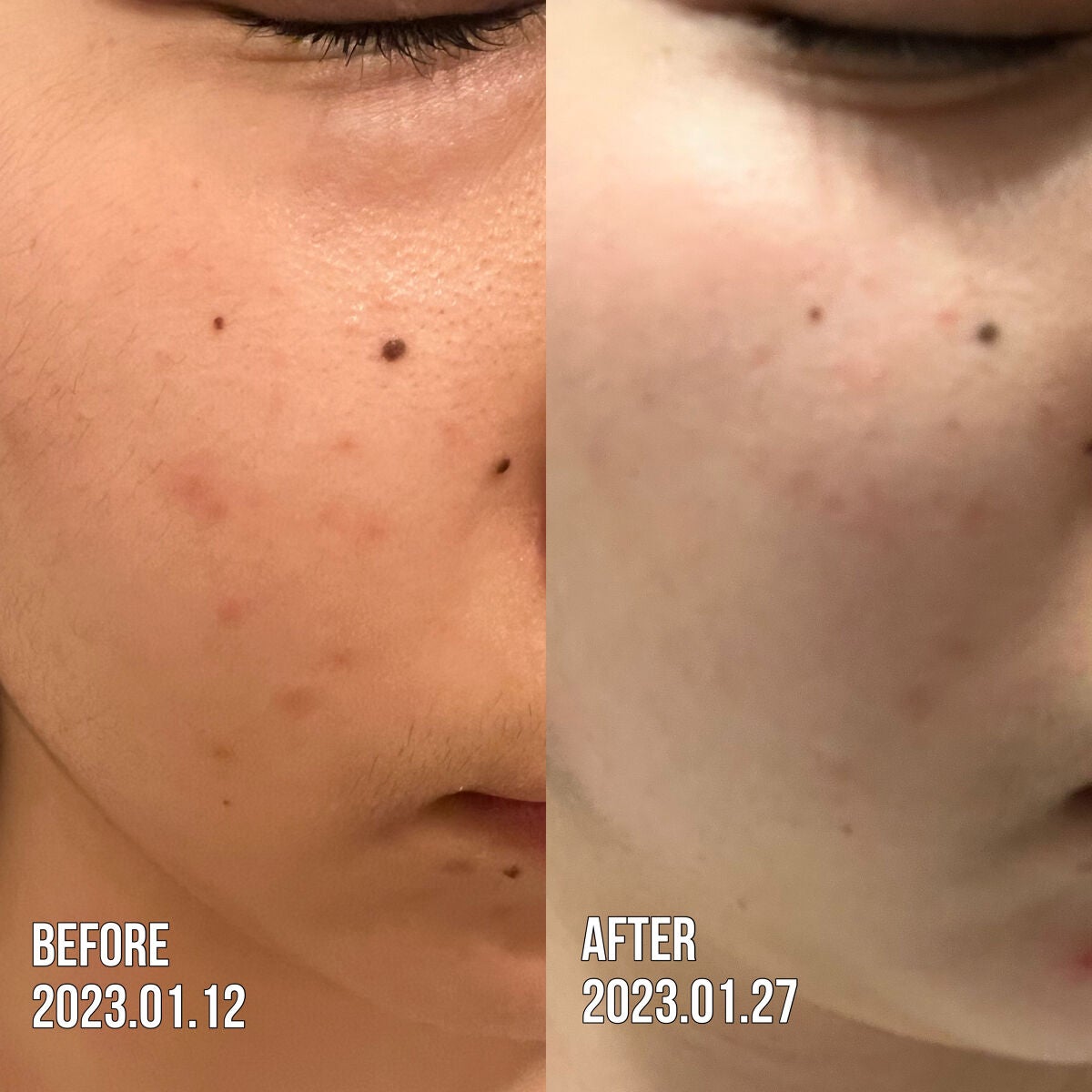 ル・マイルド化粧水/ル・マイルド/化粧水を使ったクチコミ(2枚目)