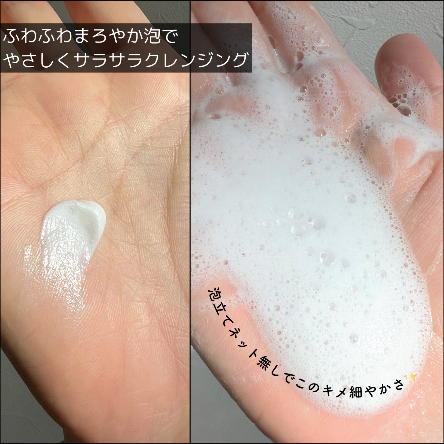 スイスキン 新芽ディープクレンジングフォーム/suiskin/洗顔フォームを使ったクチコミ(3枚目)