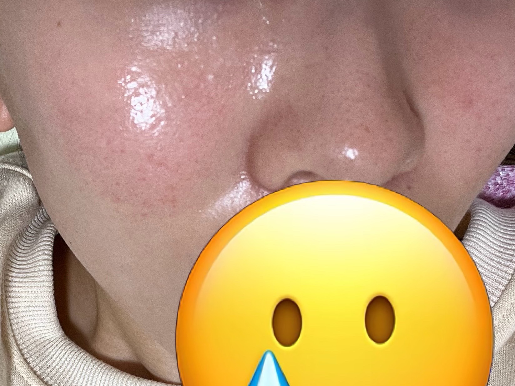 VT シカ VCマスク/VT/シートマスク・パックを使ったクチコミ（3枚目）