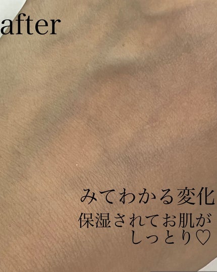 HA Boosting Serum /NATURAL DERMA PROJECT/ブースター・導入液を使ったクチコミ(5枚目)