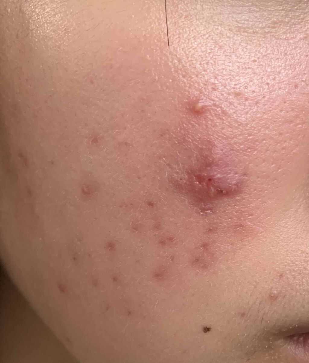 乳液・敏感肌用・しっとりタイプ/無印良品/乳液を使ったクチコミ(3枚目)