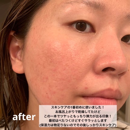 オーロラスキン デイリーブースト/IKNOWSNOW/美容液を使ったクチコミ(9枚目)