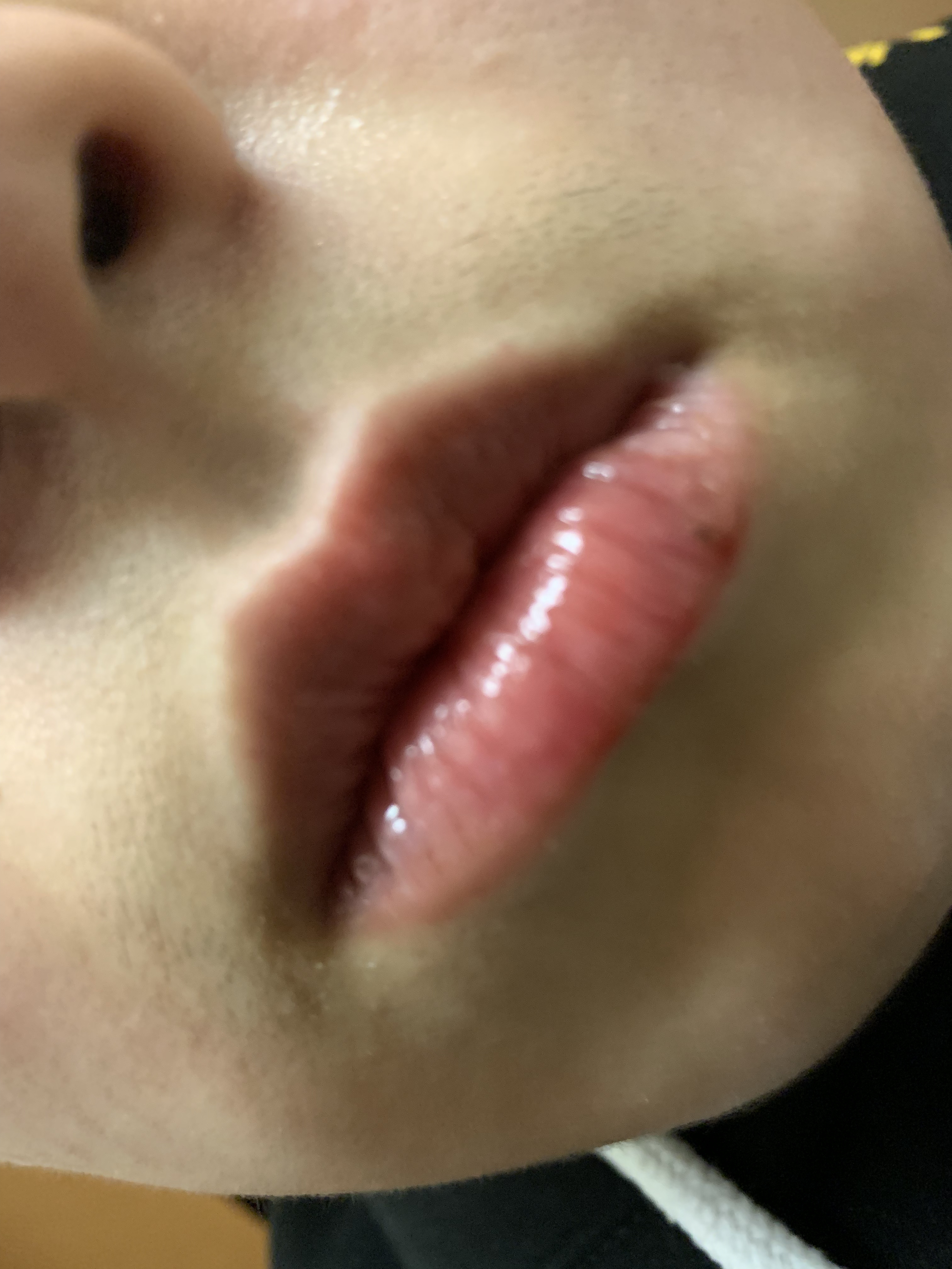 アンドバイロムアンド　グラッシーボムティント/&nd by rom&nd/リップティントを使ったクチコミ（3枚目）