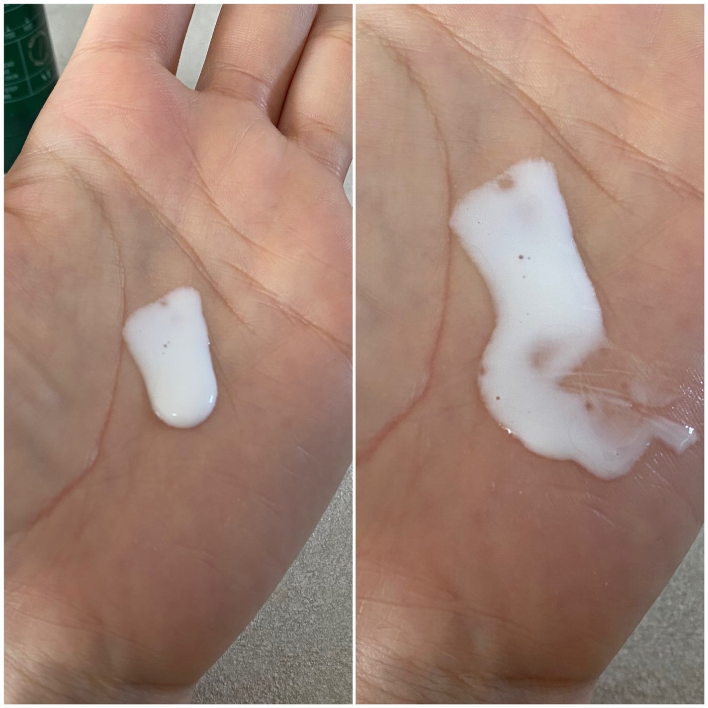 プロCICAリードルショット100/VT/ブースター・導入液を使ったクチコミ(5枚目)