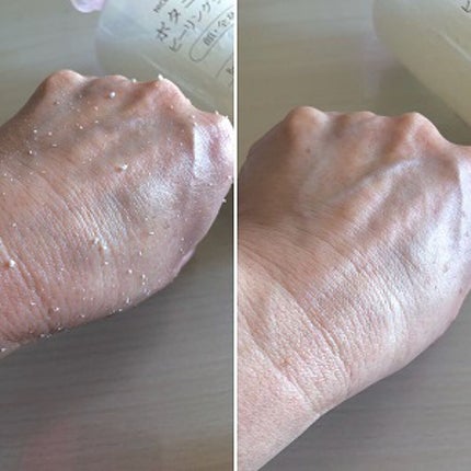 ボタニカルピーリングジェル/NICE & QUICK/ピーリングを使ったクチコミ(3枚目)