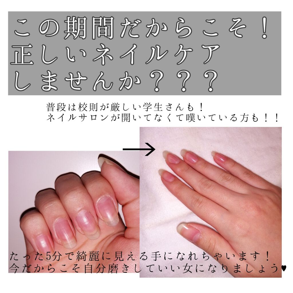 エテュセ クイックケアコート/ettusais/ネイルオイル・トリートメントを使ったクチコミ（1枚目）