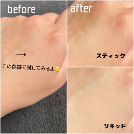 マスクフィットオールカバーデュアルコンシーラー/TIRTIR(ティルティル)/コンシーラーを使ったクチコミ(5枚目)