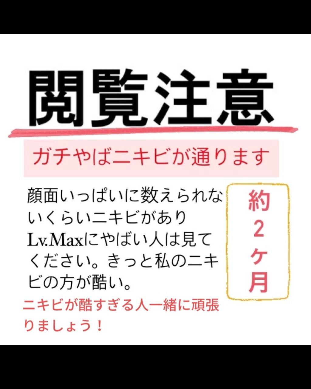 おはぎ🐰 on LIPS 「学年1のニキビ面が2ヶ月で少しマシになった話。2枚目→2020..」(1枚目)