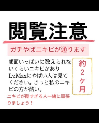 おはぎ🐰 on LIPS 「学年1のニキビ面が2ヶ月で少しマシになった話。2枚目→2020..」（1枚目）