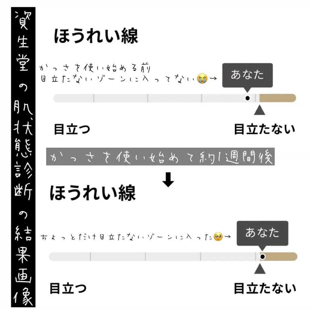 バイタリフト かっさ EH-SP85/Panasonic/美顔器・マッサージを使ったクチコミ(4枚目)
