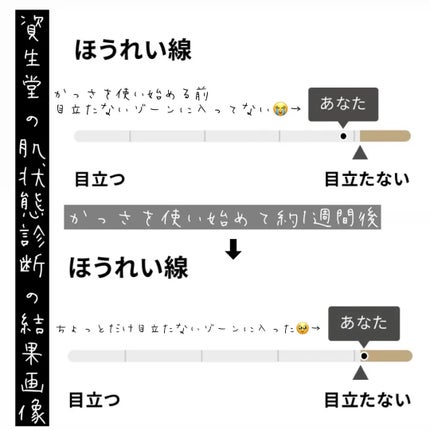 バイタリフト かっさ EH-SP85/Panasonic/美顔器・マッサージを使ったクチコミ(4枚目)