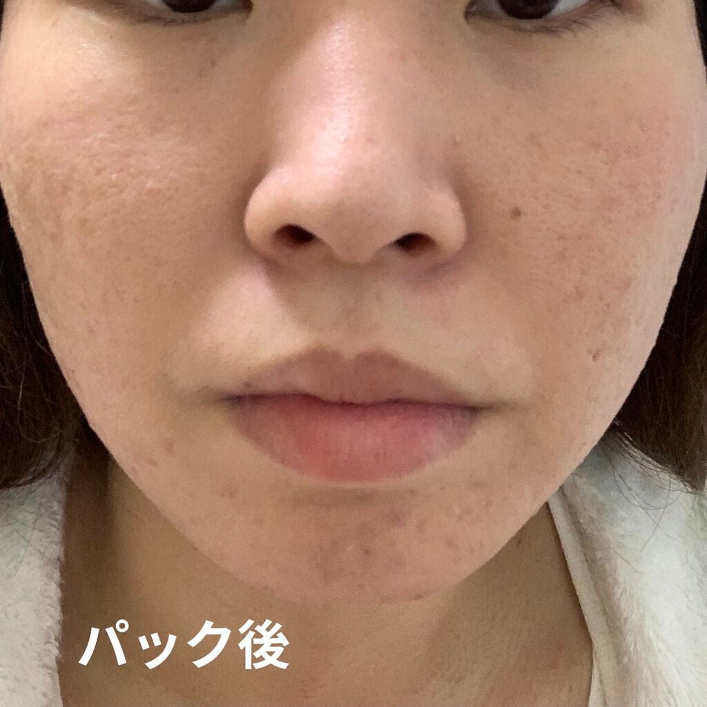 black! マスク/TIMELESS Truth Mask/シートマスク・パックを使ったクチコミ(3枚目)