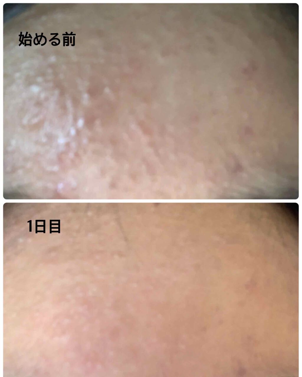 DHC ビタミンBミックス/DHC/美容サプリメントを使ったクチコミ(2枚目)