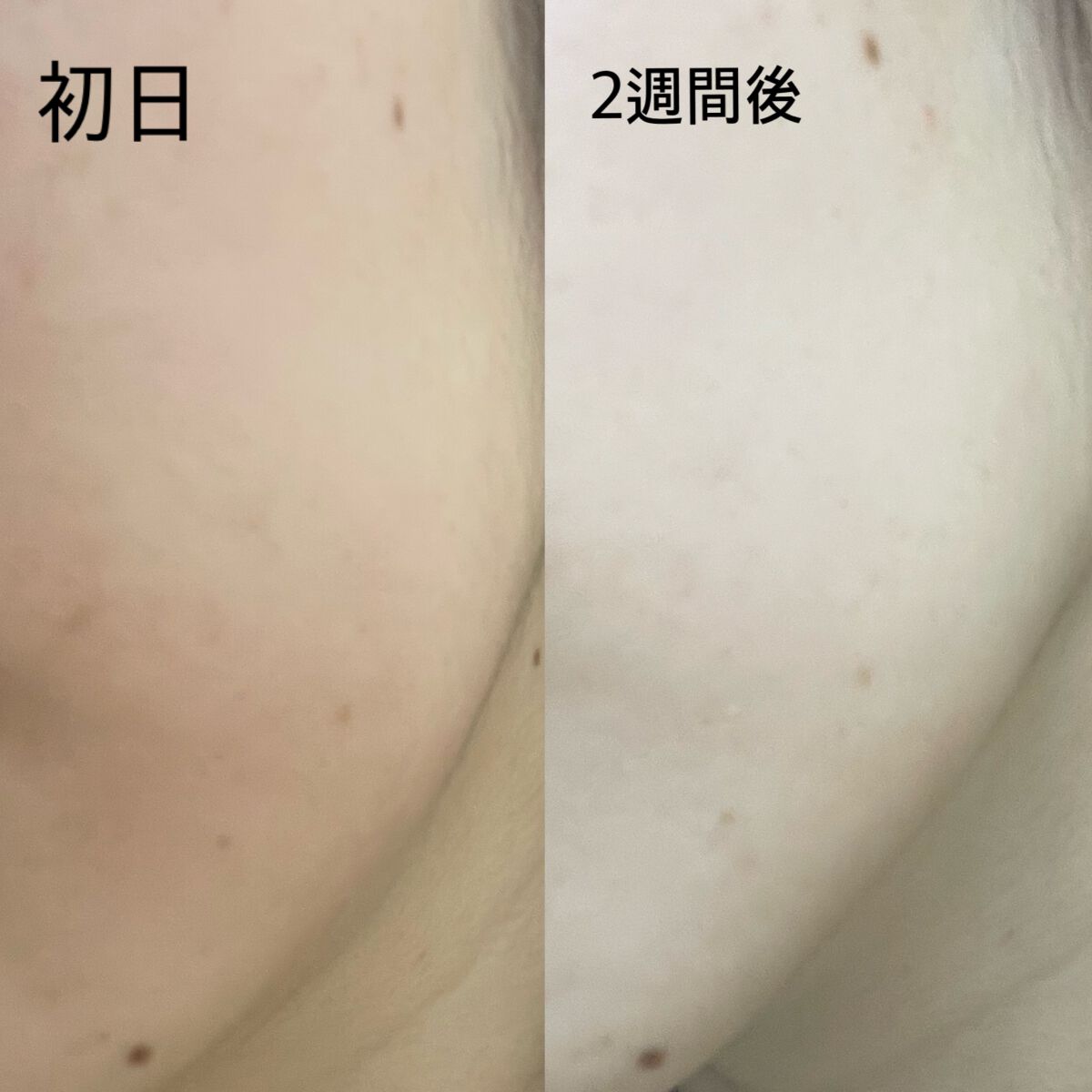 バイオ コンディショニング エッセンス/IOPE/ブースター・導入液を使ったクチコミ(4枚目)