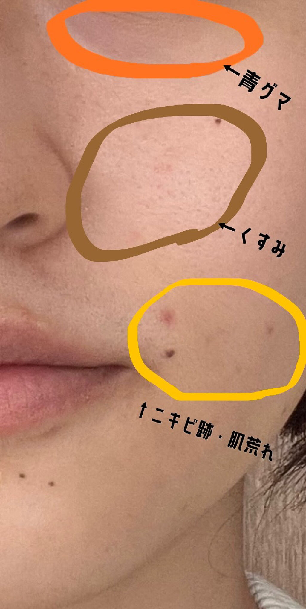 スポッツカバー ファウンデイション/SHISEIDO/クリームコンシーラーを使ったクチコミ（3枚目）