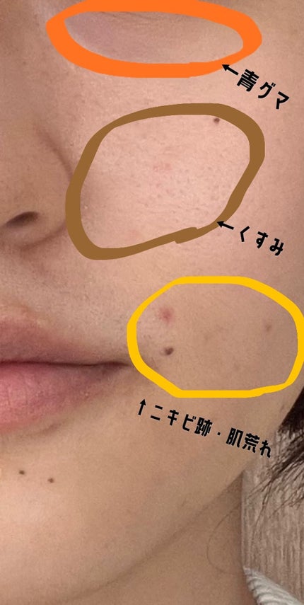 スポッツカバー ファウンデイション/SHISEIDO/クリームコンシーラーを使ったクチコミ(3枚目)