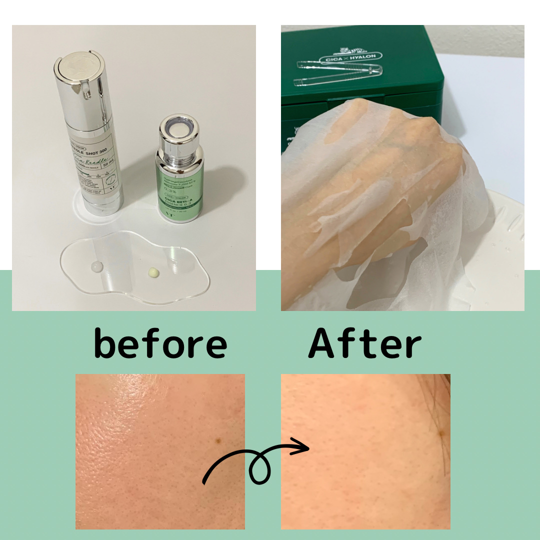 CICA デイリースージングマスク/VT/シートマスク・パックを使ったクチコミ（2枚目）