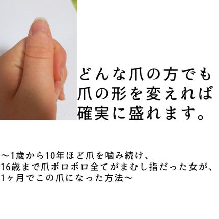 ネイルサポート ピンク/ネイルネイル/ネイルベースコートを使ったクチコミ(1枚目)