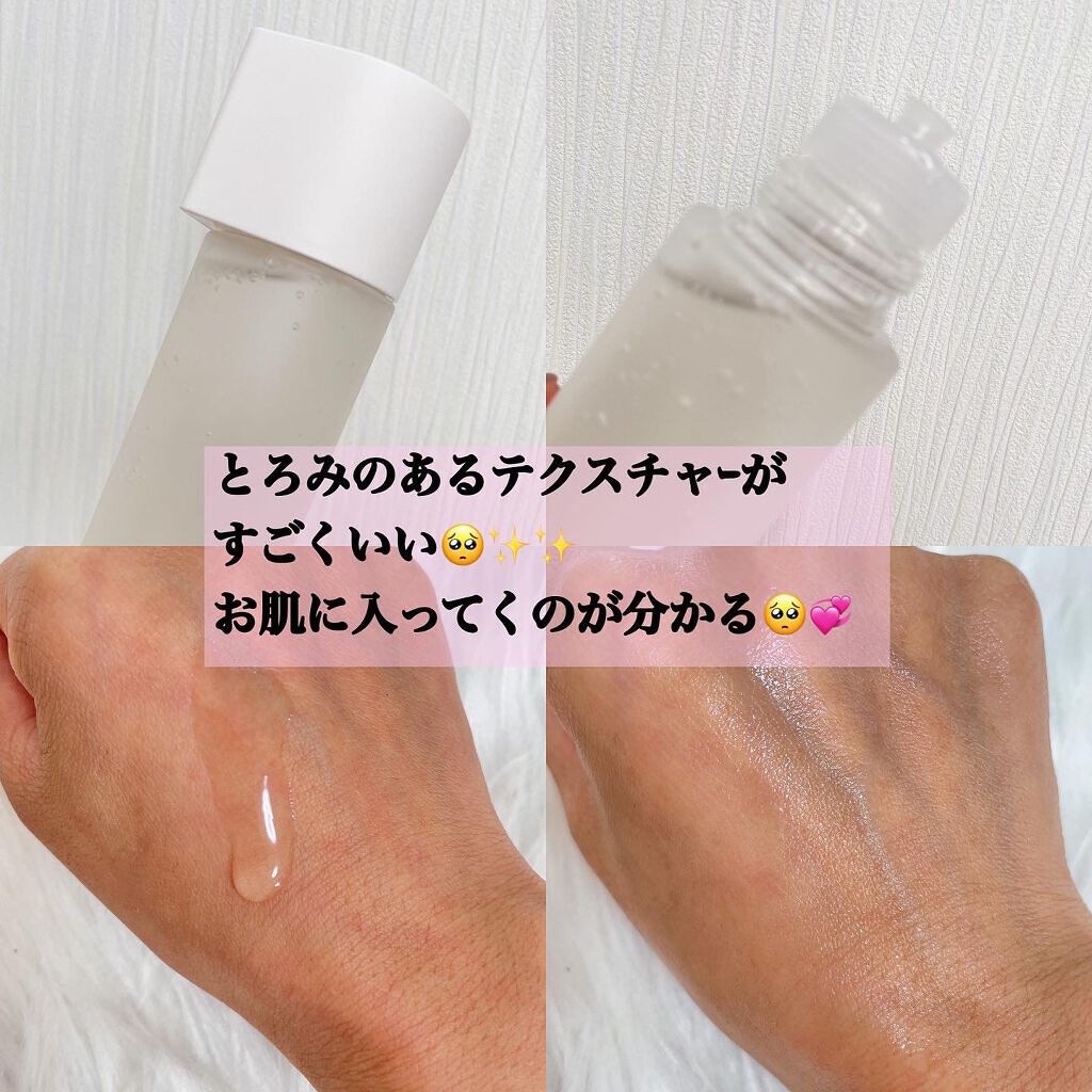 オルビスユー ローション/オルビス/化粧水を使ったクチコミ(2枚目)