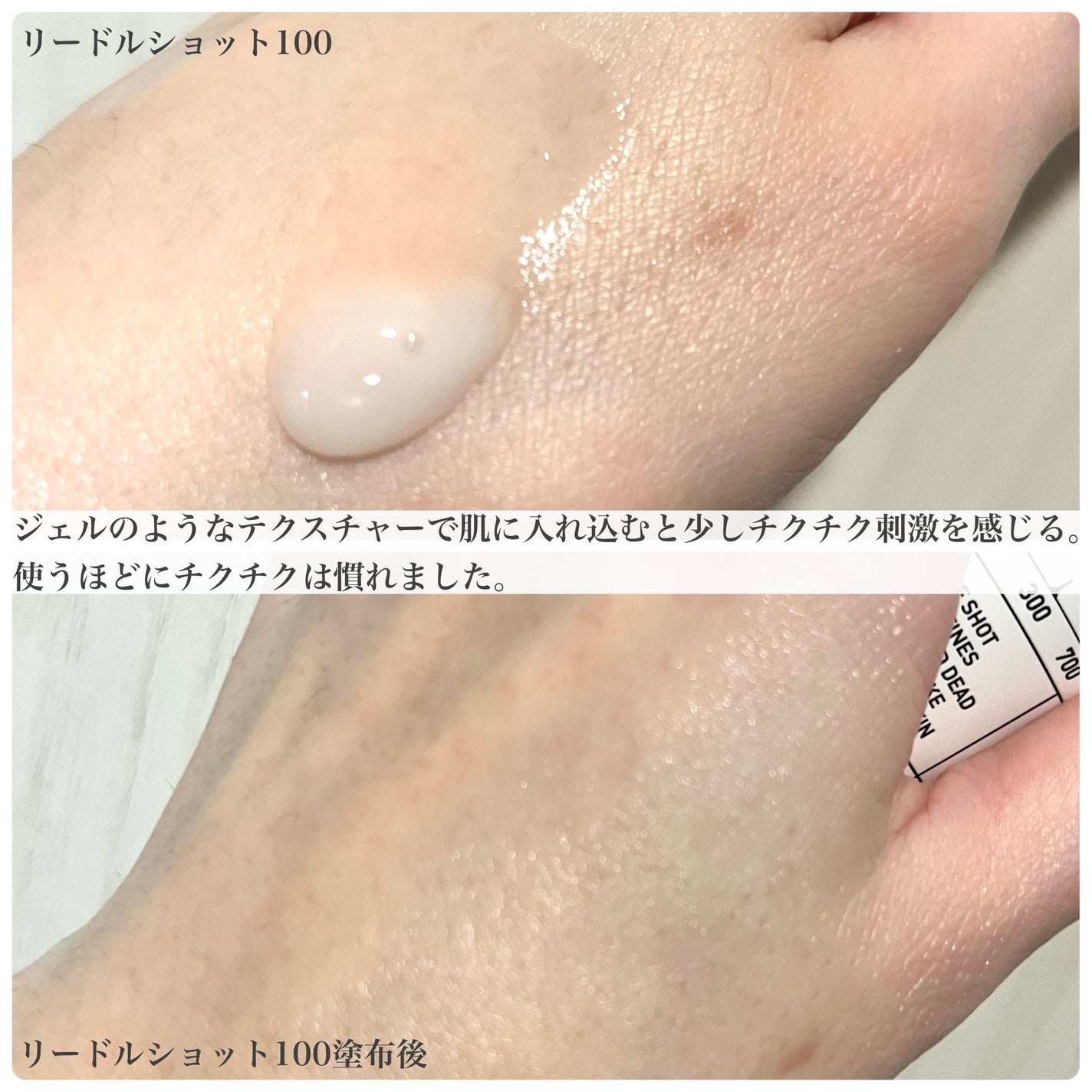 リードルショット100/VT/美容液を使ったクチコミ(2枚目)