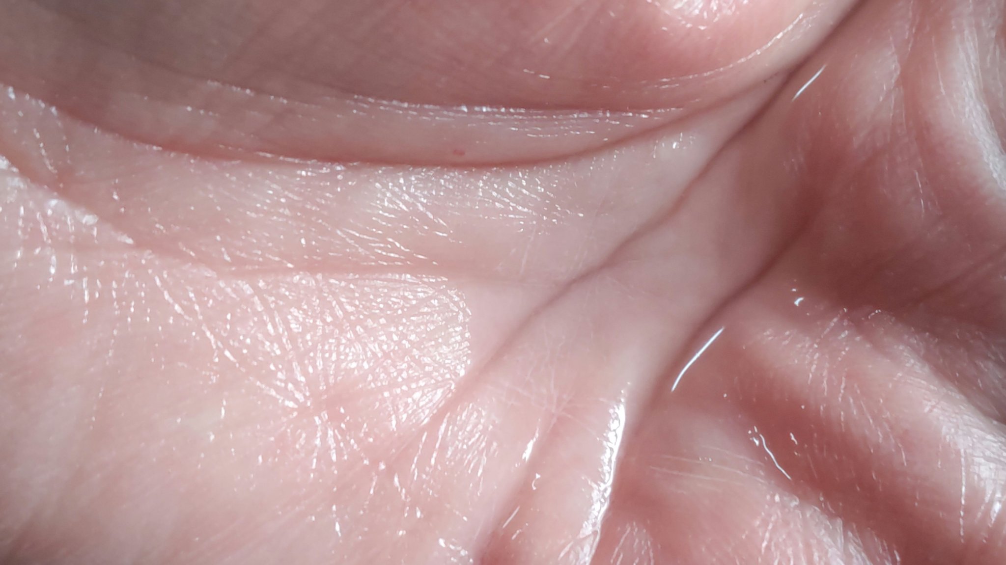 モイストバランス  ローション/ACSEINE/化粧水を使ったクチコミ（2枚目）