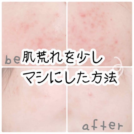 ハトムギ保湿ジェル(ナチュリエ スキンコンディショニングジェル)/ナチュリエ/美容液を使ったクチコミ(1枚目)
