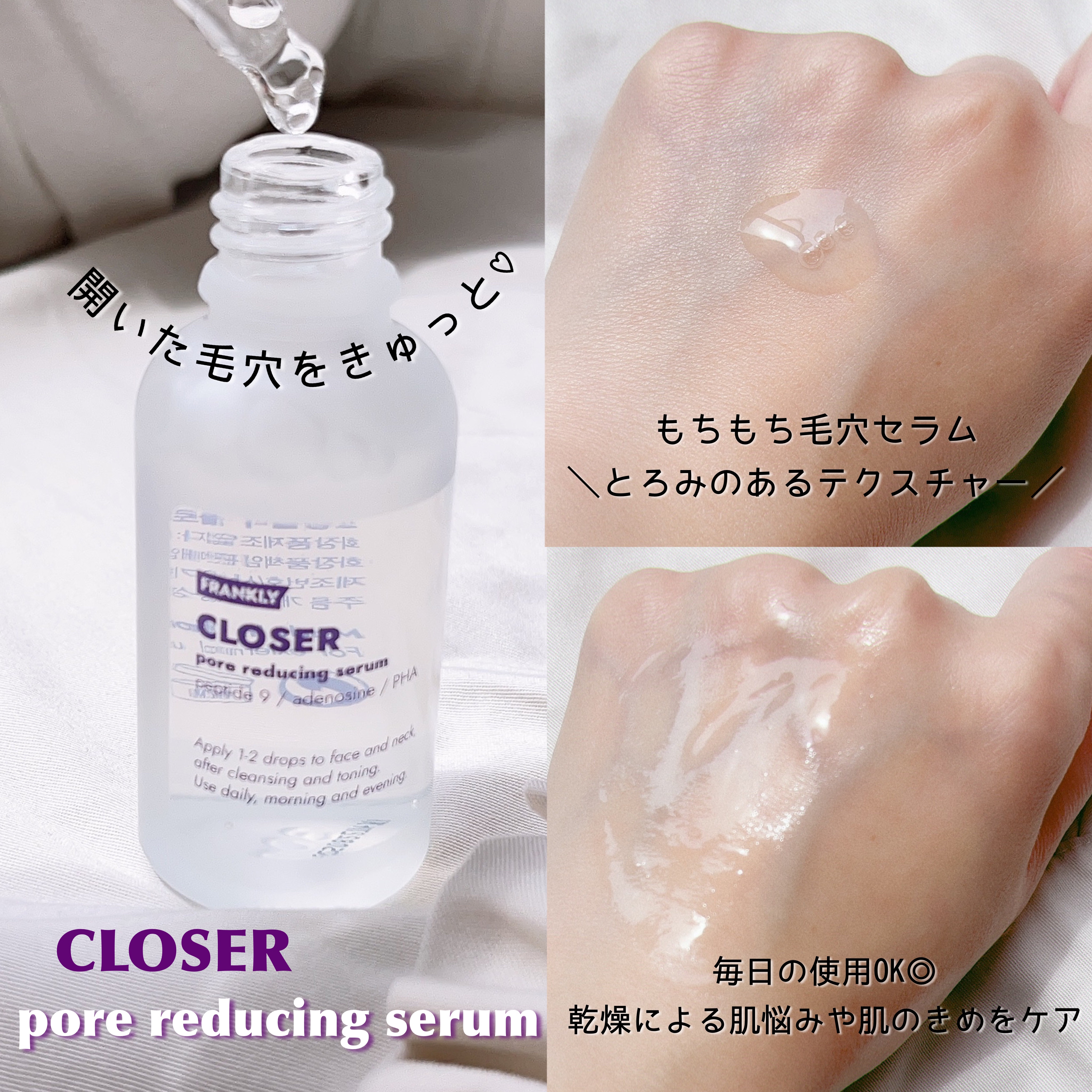 レチノール0.1％クリーム/Frankly/フェイスクリームを使ったクチコミ（2枚目）