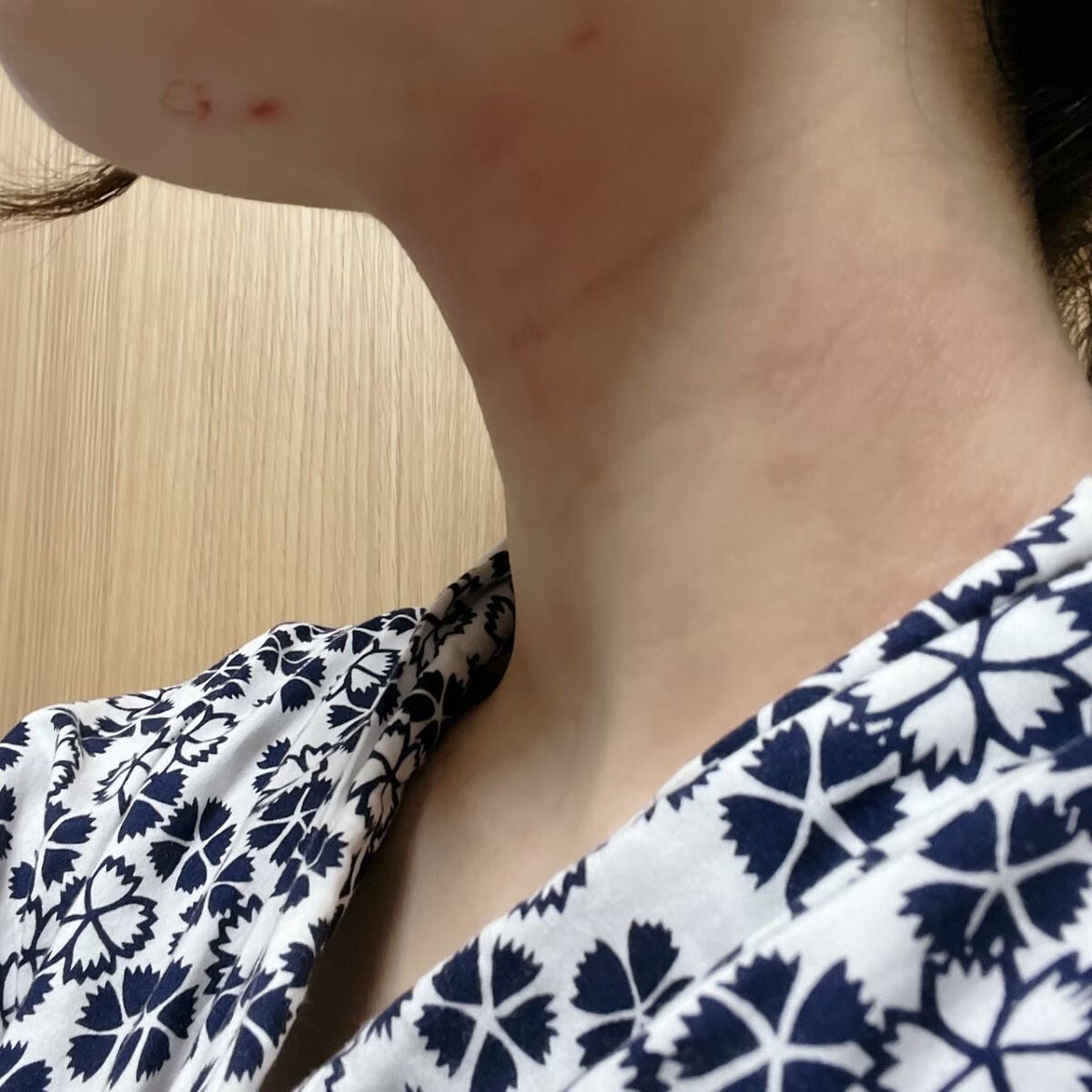 フォトシャイン/YA-MAN TOKYO JAPAN/美顔器・マッサージを使ったクチコミ(5枚目)