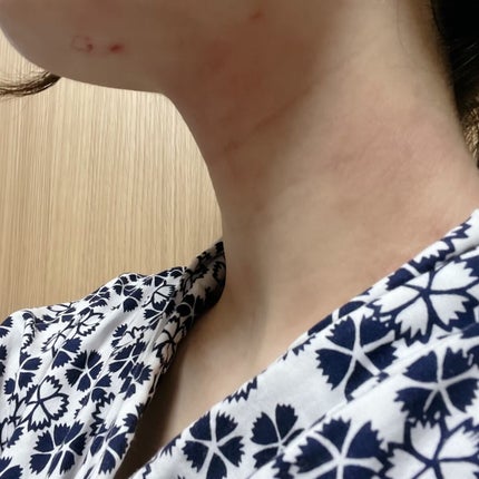 フォトシャイン/YA-MAN TOKYO JAPAN/美顔器・マッサージを使ったクチコミ(5枚目)