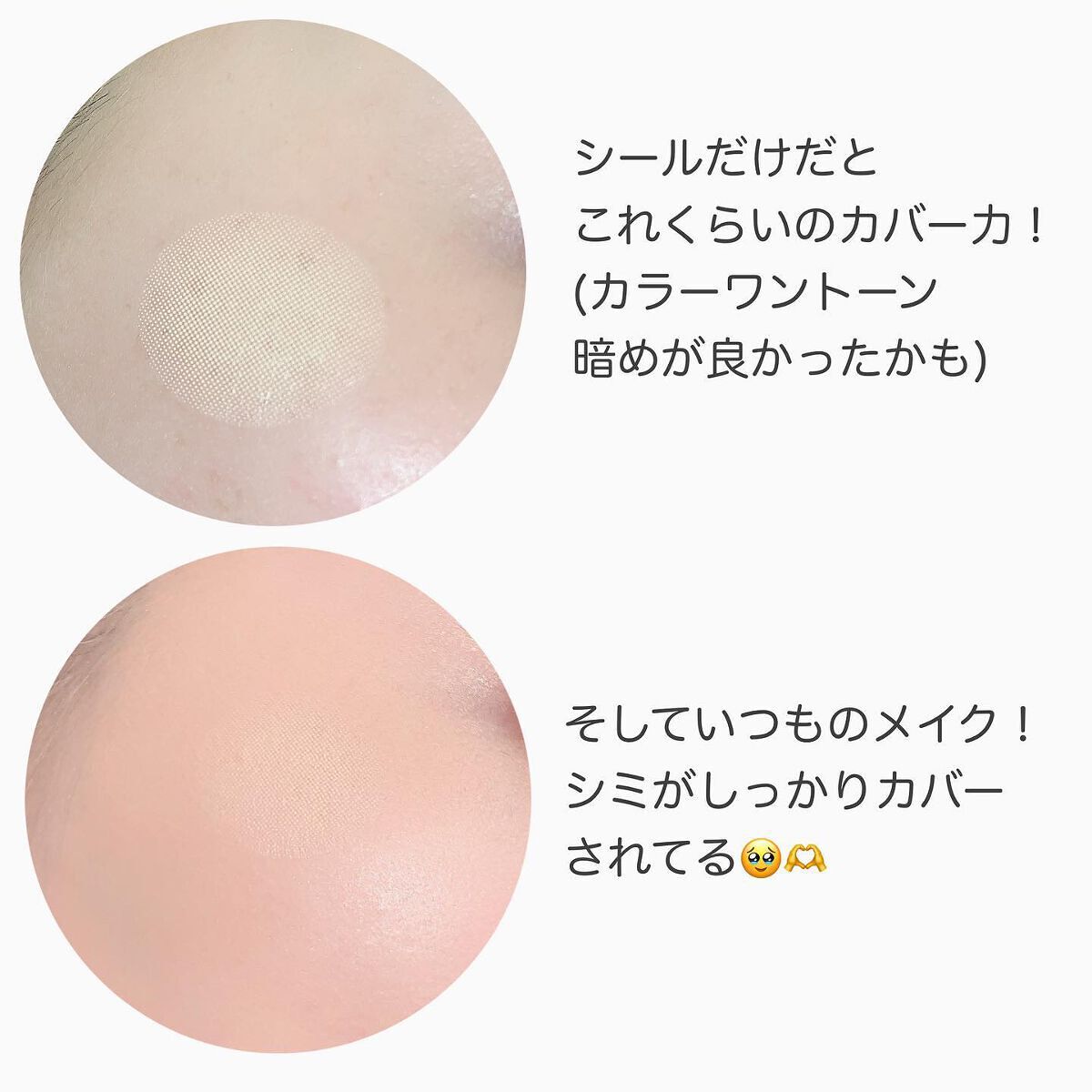 素肌シール/素肌シール/その他スキンケアグッズを使ったクチコミ(5枚目)