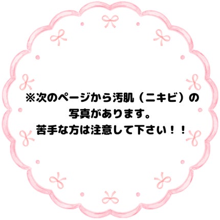 AZケア マスク/VT/シートマスク・パックを使ったクチコミ(4枚目)