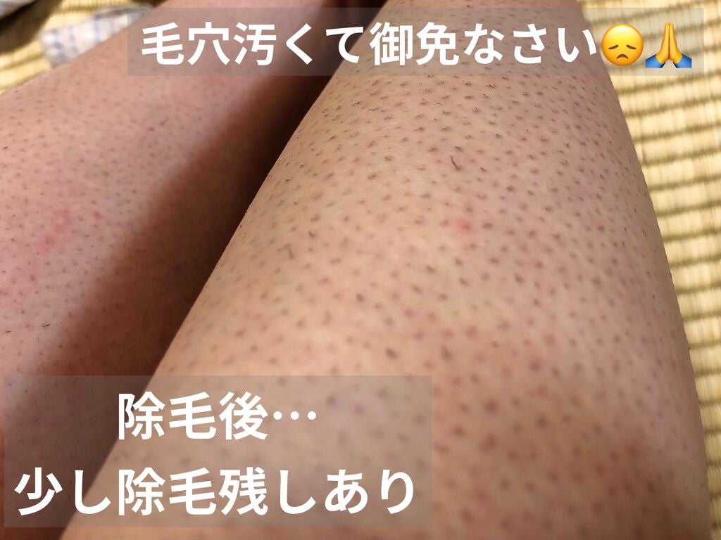 エピリムーバー/TBC/除毛クリームを使ったクチコミ(3枚目)