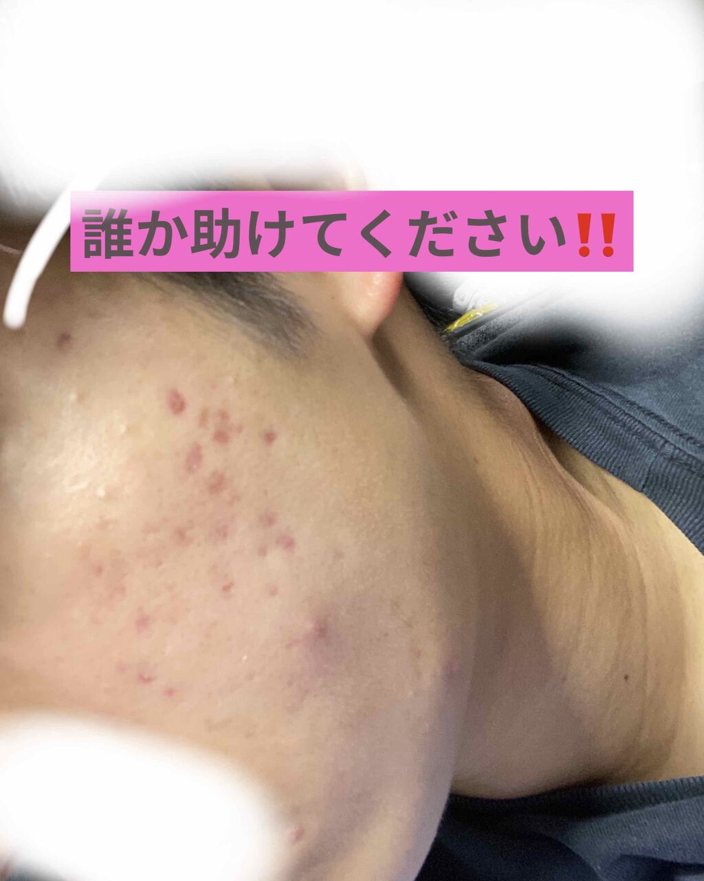 ハトムギ化粧水(ナチュリエ スキンコンディショナー R )/ナチュリエ/化粧水を使ったクチコミ（1枚目）