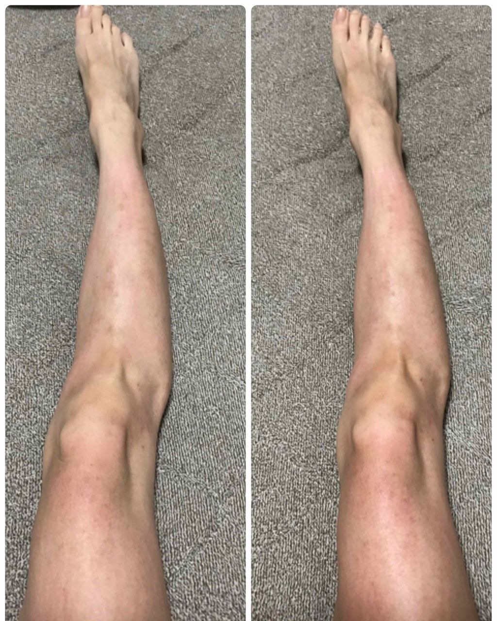 精製キャスターオイル(ひまし油)/マンデイムーン/フェイスオイルを使ったクチコミ（3枚目）