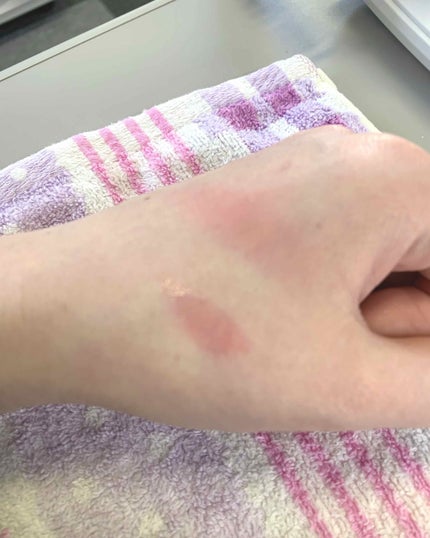 ヴォリュプテ ティントインオイル/YVES SAINT LAURENT BEAUTE/リップグロスを使ったクチコミ(2枚目)