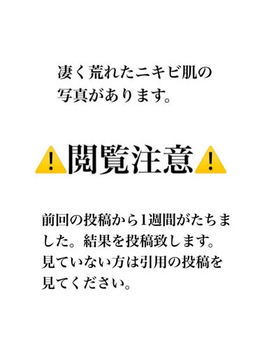 薬用 しみ 集中対策 美容液/メラノCC/美容液を使ったクチコミ（1枚目）