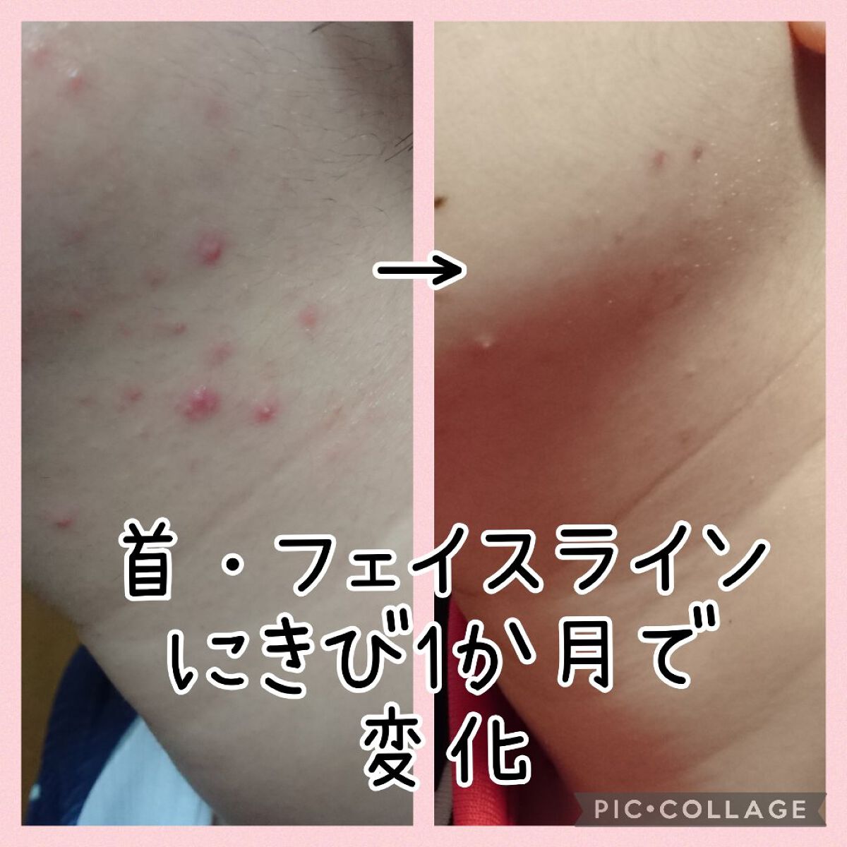 CICA クリーム/VT/フェイスクリームを使ったクチコミ(1枚目)