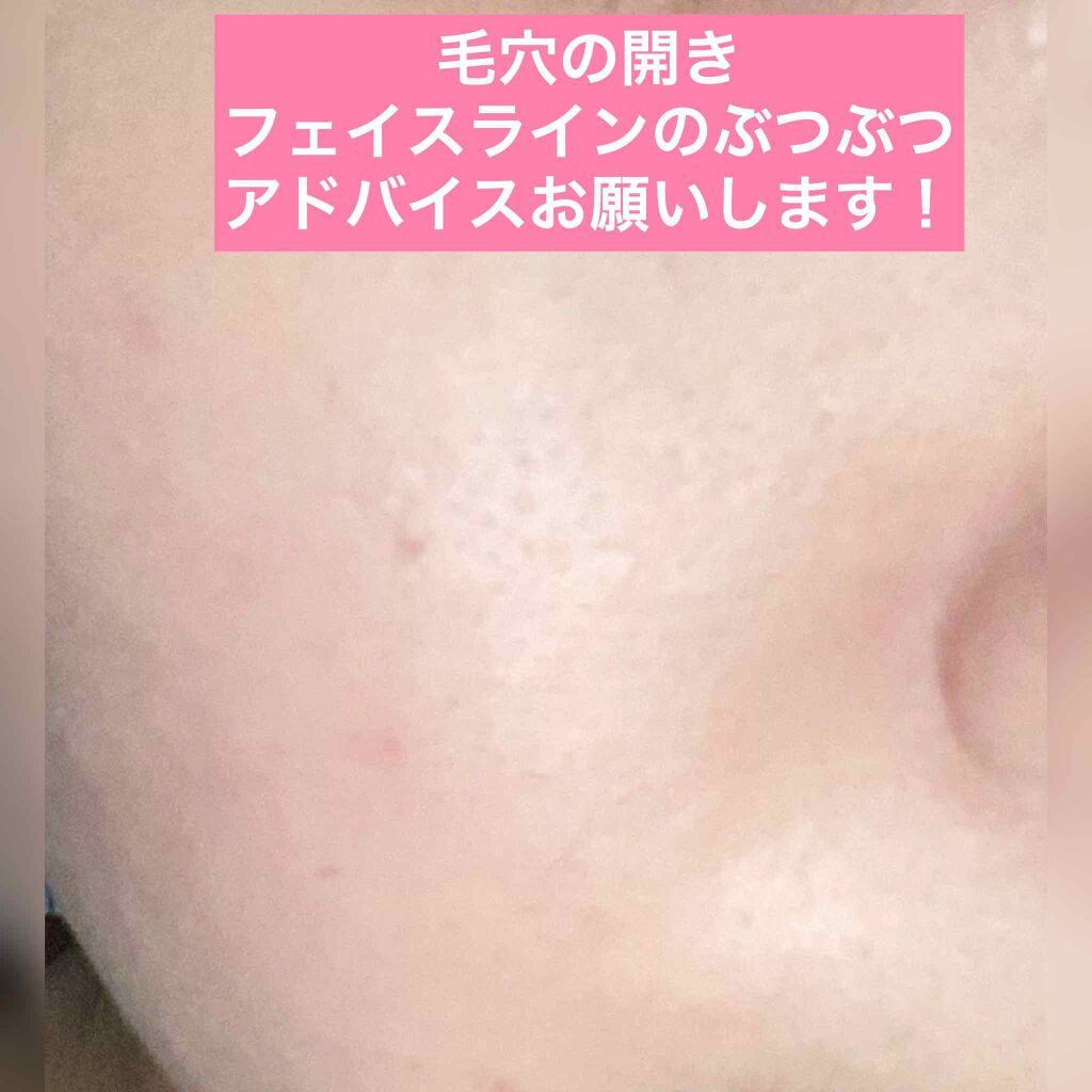 バランスケア ローション W II/d プログラム/化粧水を使ったクチコミ(1枚目)