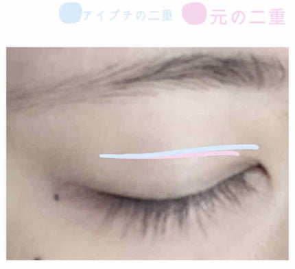アイトーク/アイトーク/二重まぶた用アイテムを使ったクチコミ(2枚目)