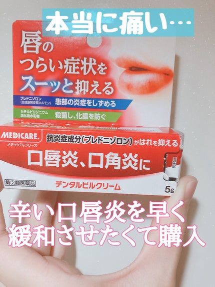 デンタルピルクリーム(医薬品)/メディケア/その他を使ったクチコミ(1枚目)