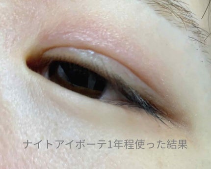 ダブルアイリキッド/Automatic Beauty/二重まぶた用アイテムを使ったクチコミ(2枚目)