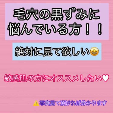 皆さんこんにちは！sanaです☺️
今回も見て下さりありがとうございます！！
今回は、誰でも1度は経験した事があると思います【毛穴の黒ずみ⠀】についてお話していこうと思います😌最後まで見て下さると嬉しい