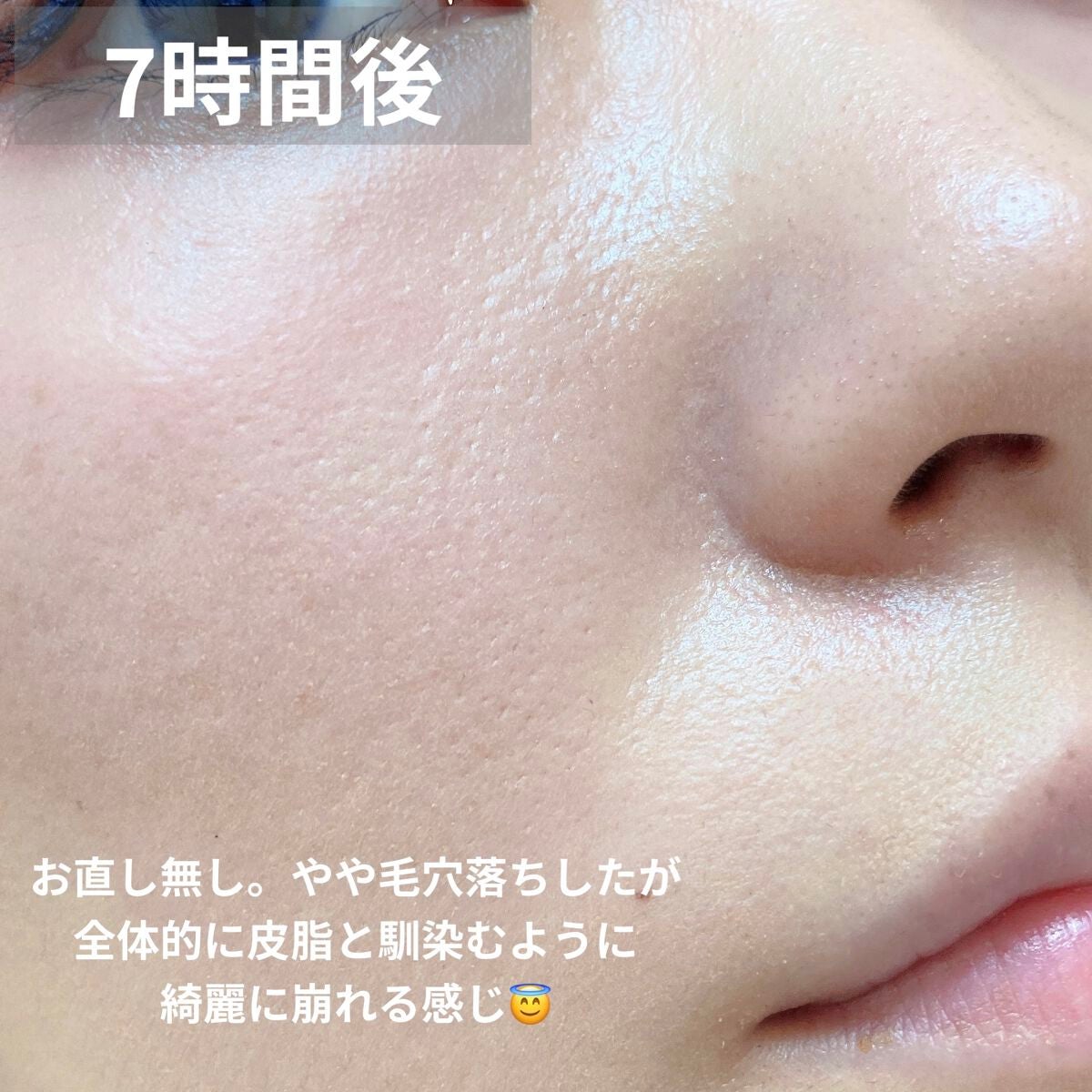 サンメディックUV薬用BBプロテクトEX/資生堂薬品/BBクリームを使ったクチコミ(4枚目)