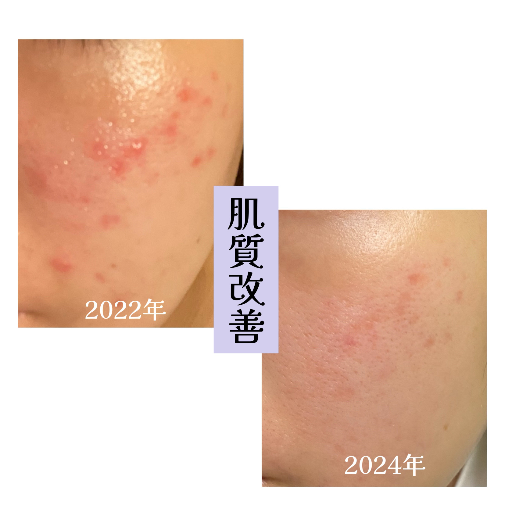 ミノン アミノモイスト エイジングケア デイクリームUV/ミノン/日焼け止めクリームを使ったクチコミ（1枚目）