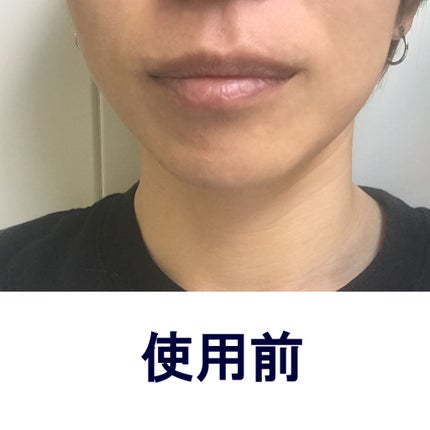 モティブリッププランパー/KAKEHIKI/リッププランパーを使ったクチコミ(2枚目)